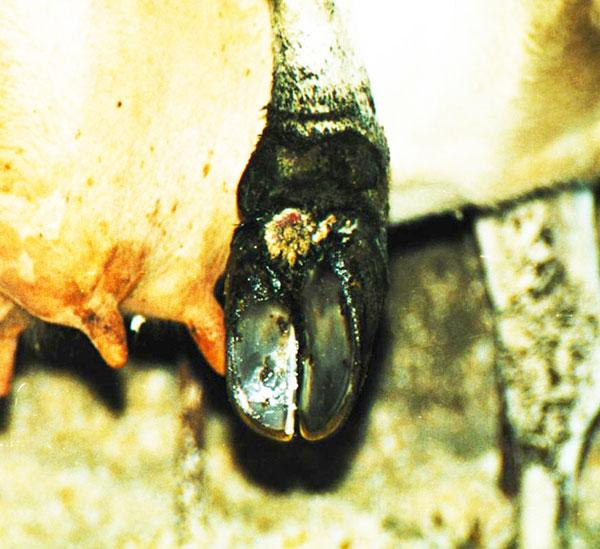 Preventing & Treating _HeelWart_2